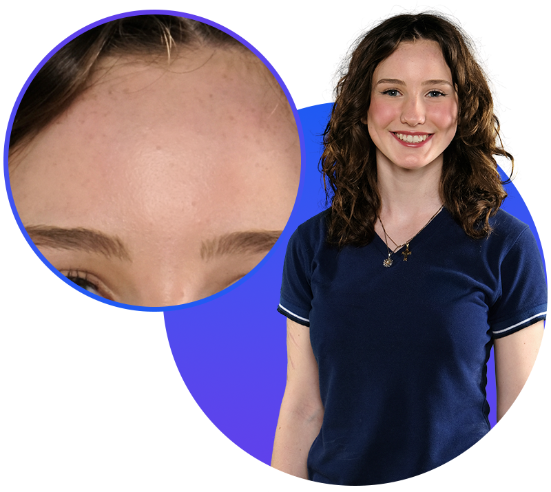 Face Shine Correction Closeup